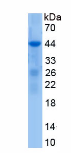 Recombinant Thrombospondin 4 (THBS4)
