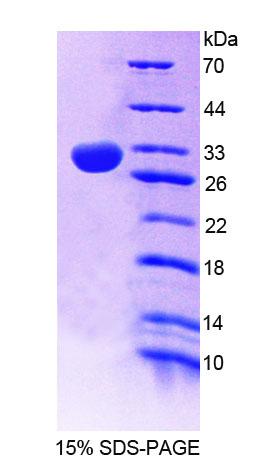 Recombinant Phospholipase C Epsilon 1 (PLCe1)