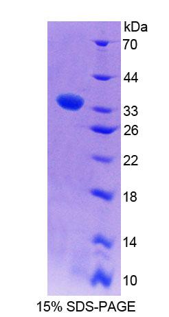 Recombinant Phospholipase C Epsilon 1 (PLCe1)