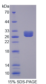 Recombinant Phospholipase C Gamma 2, Phosphatidylinositol Specific (PLCg2)