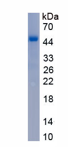 Recombinant Aspartate Aminotransferase 2 (AST2)