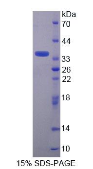 Recombinant Alanine Glyoxylate Aminotransferase 2 (AGXT2)