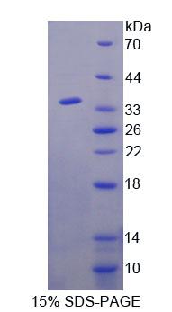 Recombinant Alanine Glyoxylate Aminotransferase 2 (AGXT2)