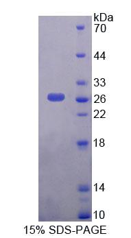 Recombinant Aminoadipate Aminotransferase (AADAT)