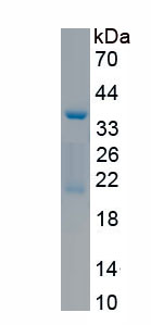 Recombinant Aminoadipate Aminotransferase (AADAT)