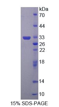 Recombinant 4-Aminobutyrate Aminotransferase (ABAT)