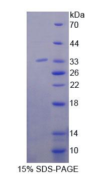 Recombinant 4-Aminobutyrate Aminotransferase (ABAT)