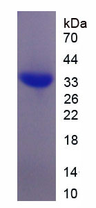 Recombinant 4-Aminobutyrate Aminotransferase (ABAT)