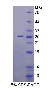 Recombinant Branched Chain Aminotransferase 1, Cytosolic (BCAT1)