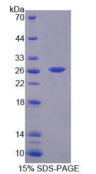 Recombinant Branched Chain Aminotransferase 1, Cytosolic (BCAT1)