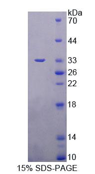 RPD859Hu01.jpg