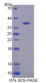Recombinant Ornithine Aminotransferase (OAT)