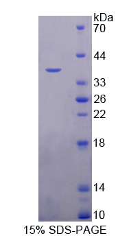 Recombinant Phosphoserine Aminotransferase 1 (PSAT1)