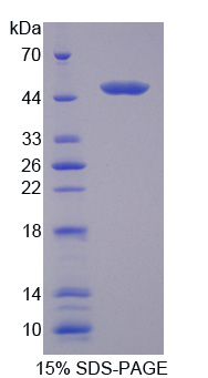 Recombinant Cysteine Conjugate Beta Lyase, Cytoplasmic (CCbL1)