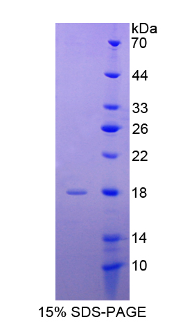 RPD873Hu01.jpg