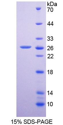 Recombinant Dipeptidyl Peptidase 6 (DPP6)