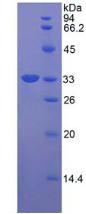 Recombinant RAR Related Orphan Receptor Gamma (RORg)