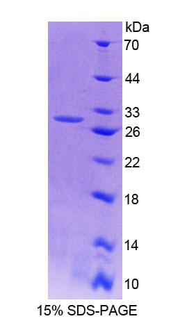 Recombinant Testicular Receptor 4 (TR4)