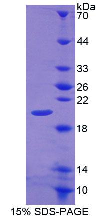 Recombinant Calcyon Neuron Specific Vesicular Protein (CALY)