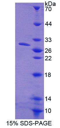 Recombinant Calcineurin Like Phosphoesterase Domain Containing Protein 1 (CPPED1)
