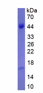 Recombinant Neurofilament, Heavy Polypeptide (NEFH)