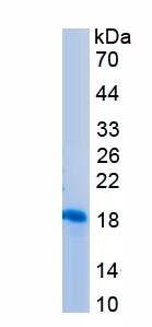 Recombinant Neurofilament, Light Polypeptide (NEFL)