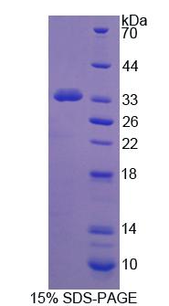 Recombinant Protocadherin 15 (PCDH15)