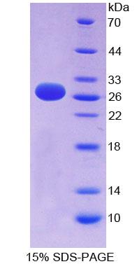 RPE109Hu01.jpg