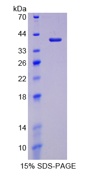 Recombinant Lactate Dehydrogenase C (LDHC)