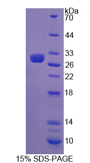 Recombinant Interferon Alpha/Beta Receptor 2 (IFNa/bR2)