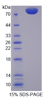 Recombinant Proprotein Convertase Subtilisin/Kexin Type 9 (PCSK9)