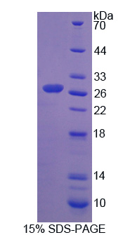 Recombinant Chymotrypsinogen B1 (CTRB1)