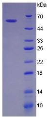 Recombinant Baculoviral IAP Repeat Containing Protein 2 (BIRC2)