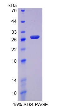 Recombinant Cysteine Dioxygenase I (CDO1)