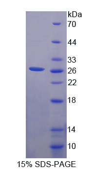 Recombinant Cysteine Dioxygenase I (CDO1)