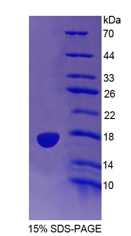 Recombinant Indoleamine-2,3-Dioxygenase 2 (IDO2)