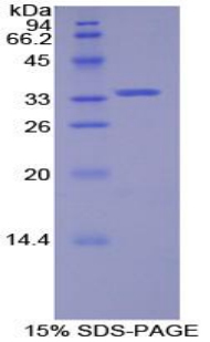 Recombinant Spleen Tyrosine Kinase (SYK)