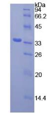 Recombinant Spleen Tyrosine Kinase (SYK)