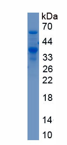 Recombinant IQ Motif Containing GTPase Activating Protein 1 (IQGAP1)