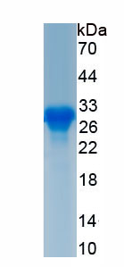 Recombinant Vesicular Glutamate Transporter 1 (VGLUT1)