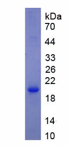 Recombinant Sodium/Glucose Cotransporter 1 (SGLT1)