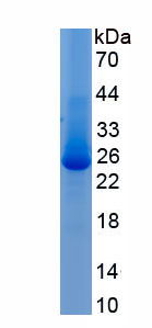 RPE419Hu02.jpg