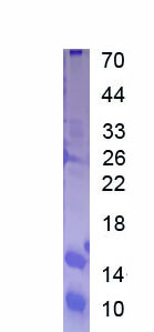 Recombinant Solute Carrier Family 30 Member 8 (SLC30A8)