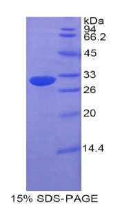 Recombinant Electron Transfer Flavoprotein Alpha Polypeptide (ETFa)