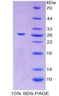 Recombinant Glycoprotein 2, Zymogen Granule Membrane (GP2)