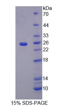 RPE570Hu01.jpg