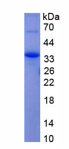 Recombinant Alpha-1-B-Glycoprotein (a1BG)