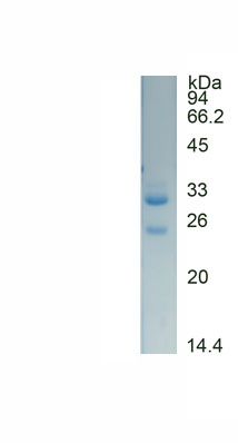 Recombinant Alpha-1-B-Glycoprotein (a1BG)