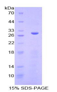 Recombinant Serum/Glucocorticoid Regulated Kinase 3 (SGK3)