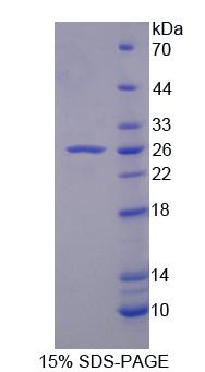 Recombinant Huntingtin Interacting Protein 2 (HIP2)